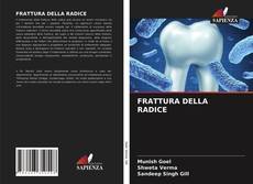 Portada del libro de FRATTURA DELLA RADICE