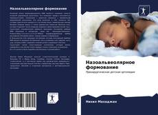 Buchcover von Назоальвеолярное формование