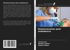 Restauraciones post endodoncia kitap kapağı