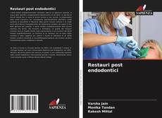 Buchcover von Restauri post endodontici