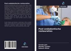 Bookcover of Post endodontische restauraties