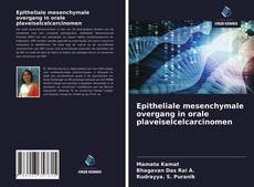 Bookcover of Epitheliale mesenchymale overgang in orale plaveiselcelcarcinomen