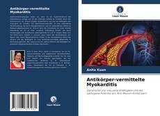 Antikörper-vermittelte Myokarditis的封面