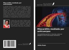 Bookcover of Miocarditis mediada por anticuerpos