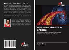 Bookcover of Miocardite mediata da anticorpi