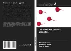Buchcover von Lesiones de células gigantes