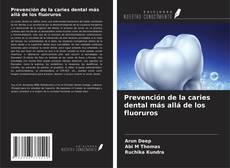 Buchcover von Prevención de la caries dental más allá de los fluoruros