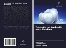 Bookcover of Preventie van tandcariës naast fluoriden