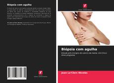 Bookcover of Biópsia com agulha