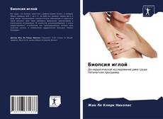 Биопсия иглой的封面