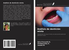 Copertina di Análisis de dentición mixta