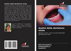 Couverture de Analisi della dentatura mista