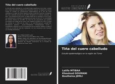 Bookcover of Tiña del cuero cabelludo