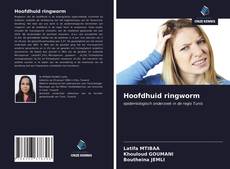 Bookcover of Hoofdhuid ringworm