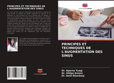 Buchcover von PRINCIPES ET TECHNIQUES DE L'AUGMENTATION DES SINUS