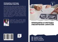 Buchcover von ПРИНЦИПЫ И МЕТОДЫ УВЕЛИЧЕНИЯ СИНУСОВ