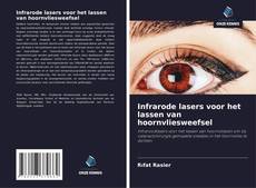 Buchcover von Infrarode lasers voor het lassen van hoornvliesweefsel