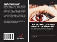 Bookcover of Lasery na podczerwień do spawania tkanki rogówki