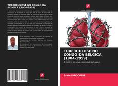 TUBERCULOSE NO CONGO DA BÉLGICA (1904-1959) kitap kapağı