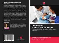 Capa do livro de Odontologia Minimamente Invasiva 