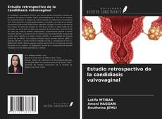 Bookcover of Estudio retrospectivo de la candidiasis vulvovaginal