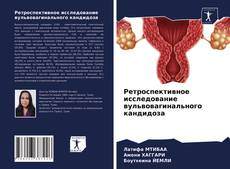 Bookcover of Ретроспективное исследование вульвовагинального кандидоза