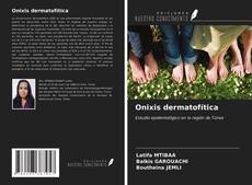 Bookcover of Onixis dermatofítica