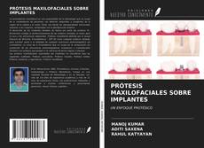 Buchcover von PRÓTESIS MAXILOFACIALES SOBRE IMPLANTES