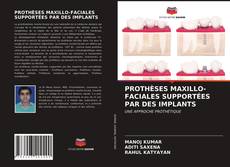 Bookcover of PROTHÈSES MAXILLO-FACIALES SUPPORTÉES PAR DES IMPLANTS