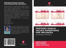 Capa do livro de PRÓTESES MAXILO-FACIAIS SUPORTADAS POR IMPLANTES 