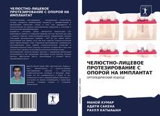 ЧЕЛЮСТНО-ЛИЦЕВОЕ ПРОТЕЗИРОВАНИЕ С ОПОРОЙ НА ИМПЛАНТАТ的封面