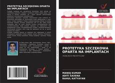 Portada del libro de PROTETYKA SZCZĘKOWA OPARTA NA IMPLANTACH