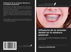 Bookcover of Influencia de la oclusión dental en la estatura postural: