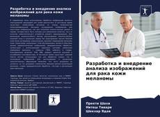 Bookcover of Разработка и внедрение анализа изображений для рака кожи меланомы