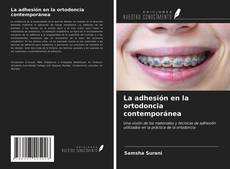 Couverture de La adhesión en la ortodoncia contemporánea