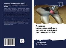 Capa do livro de Лечение нежизнеспособных, незрелых молодых постоянных зубов 