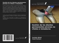 Bookcover of Gestión de los dientes permanentes jóvenes no vitales e inmaduros