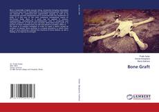 Copertina di Bone Graft