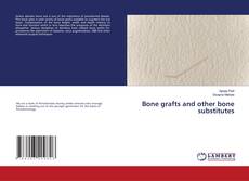 Copertina di Bone grafts and other bone substitutes