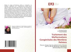 Bookcover of Traitement des Malformations Congénitales des Membres Pelviens