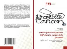 Capa do livro de Intérêt pronostique de la CRP dans le cancer de la prostate 