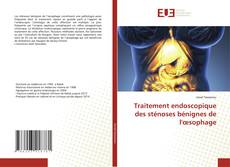 Couverture de Traitement endoscopique des sténoses bénignes de l'œsophage