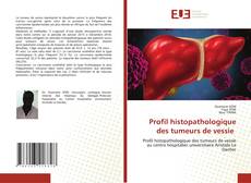 Couverture de Profil histopathologique des tumeurs de vessie