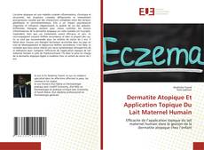 Capa do livro de Dermatite Atopique Et Application Topique Du Lait Maternel Humain 