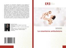 La cesarienne ambulatoire的封面