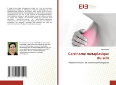 Capa do livro de Carcinome métaplasique du sein 