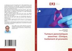 Buchcover von Tumeurs pancréatiques exocrines : Clinique, traitement et pronostic