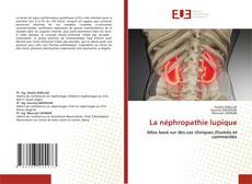 Обложка La néphropathie lupique