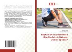 Copertina di Rupture de la syndesmose tibio-fibulaire inférieure: Quelles options?