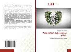 Borítókép a  Association tuberculose tabac - hoz